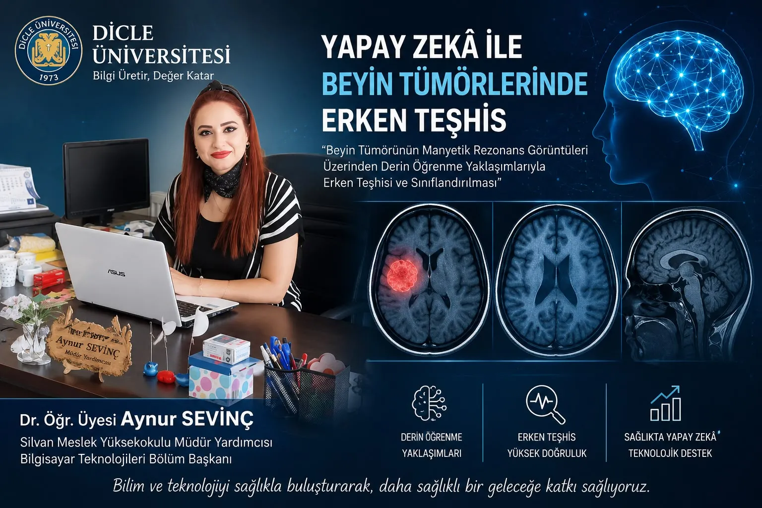 Yapay Zeka ile Beyin Tümörüne Erken Teşhis: Dicle Üniversitesi’nden Bilimsel Buluş